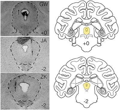 Defensive Vocalizations and Motor Asymmetry Triggered by Disinhibition of the Periaqueductal Gray in Non-human Primates